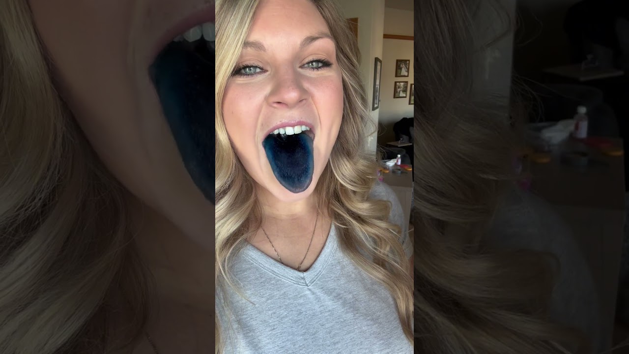 What is METHYLENE BLUE?